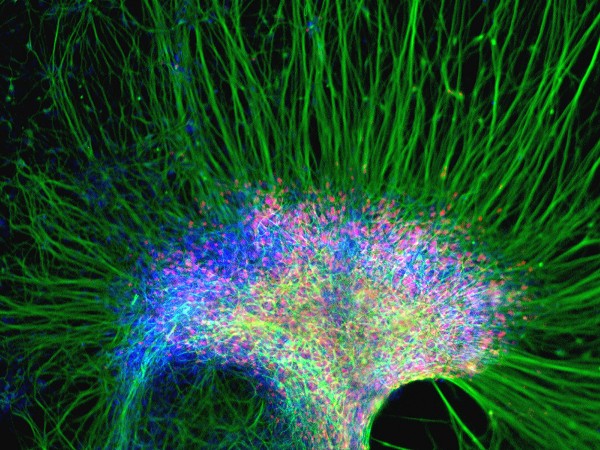 zhang_neural_stem_cells04 Photo: cluster of neural cells by Su-Chan Zhang, University Wisconsin-Madison